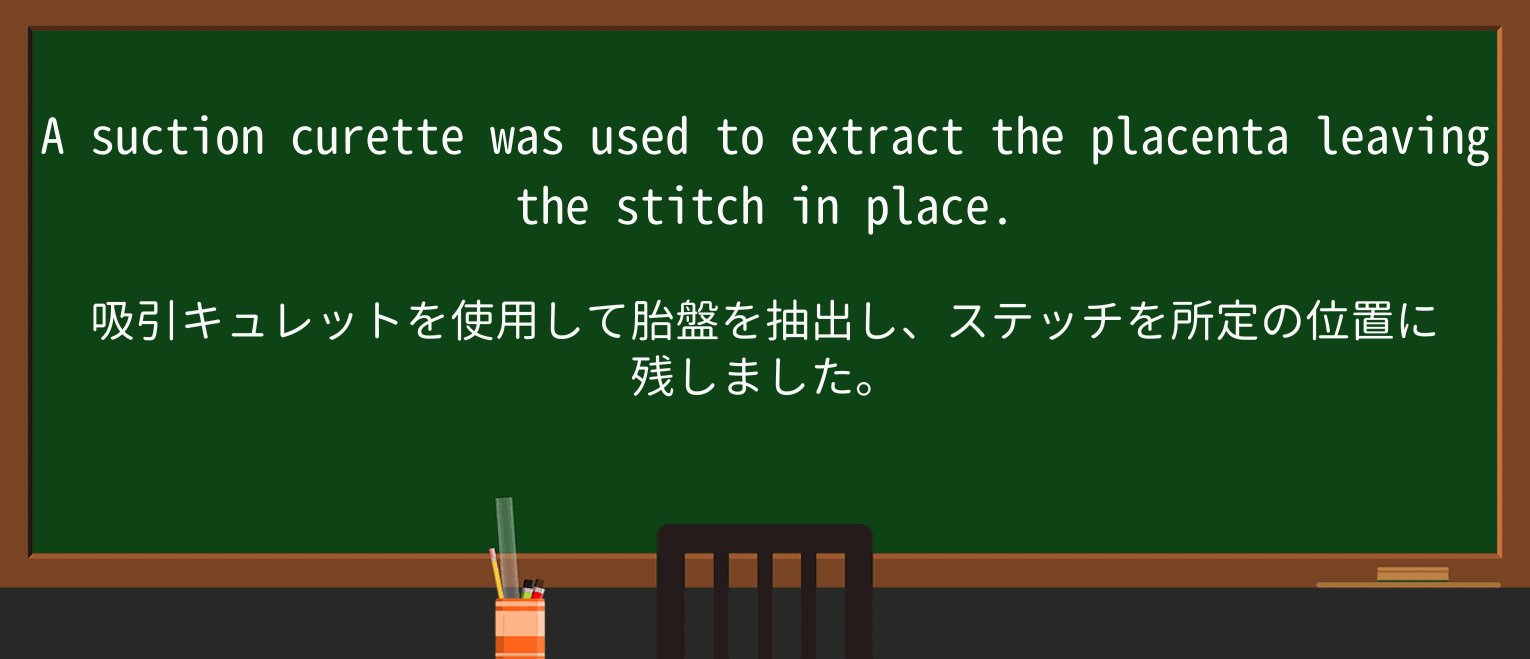 【英単語】stitchを徹底解説!意味、使い方、例文、読み方 ・例文2