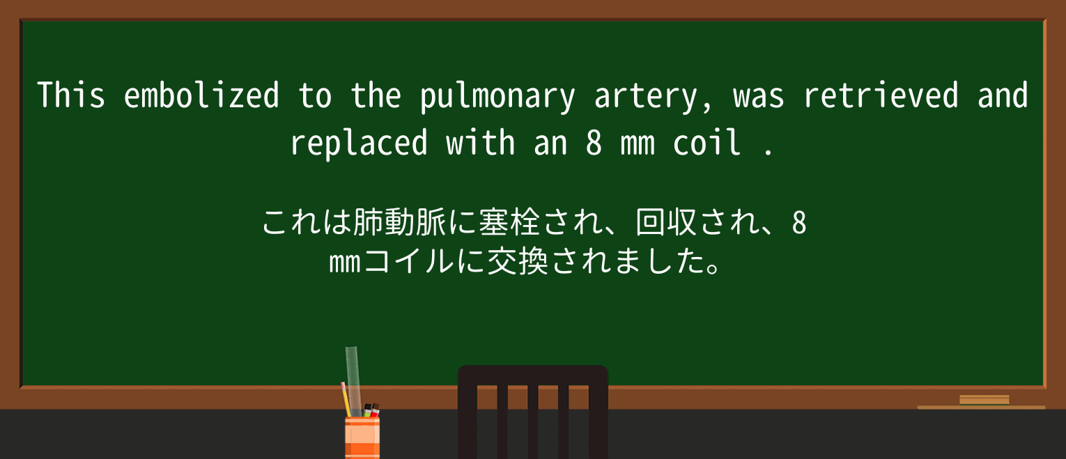 【英単語】coilを徹底解説!意味、使い方、例文、読み方 ・例文3