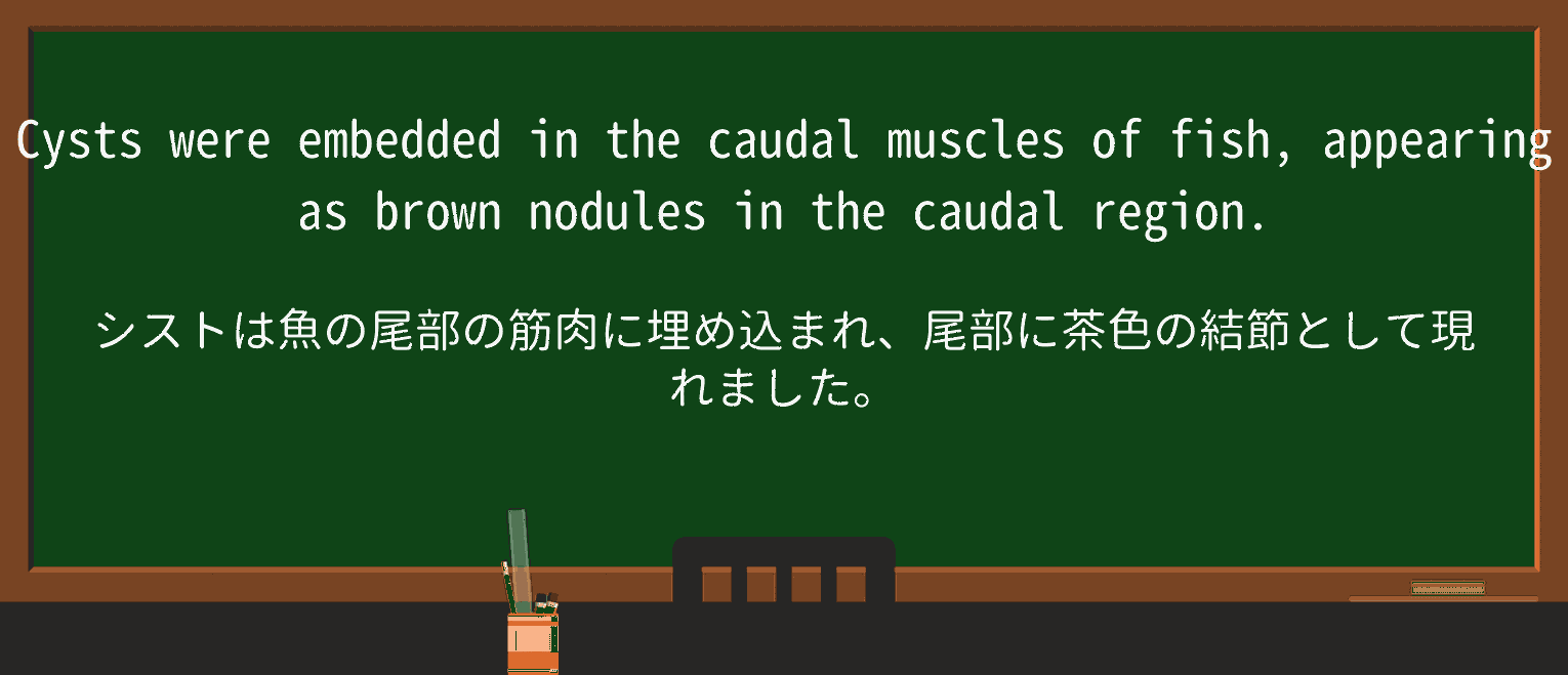 【英単語】noduleを徹底解説!意味、使い方、例文、読み方 ・例文4