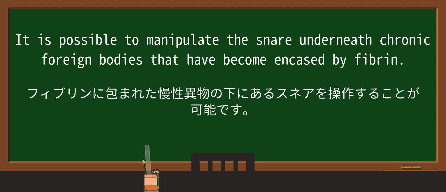 【英単語】encaseを徹底解説!意味、使い方、例文、読み方 ・例文2