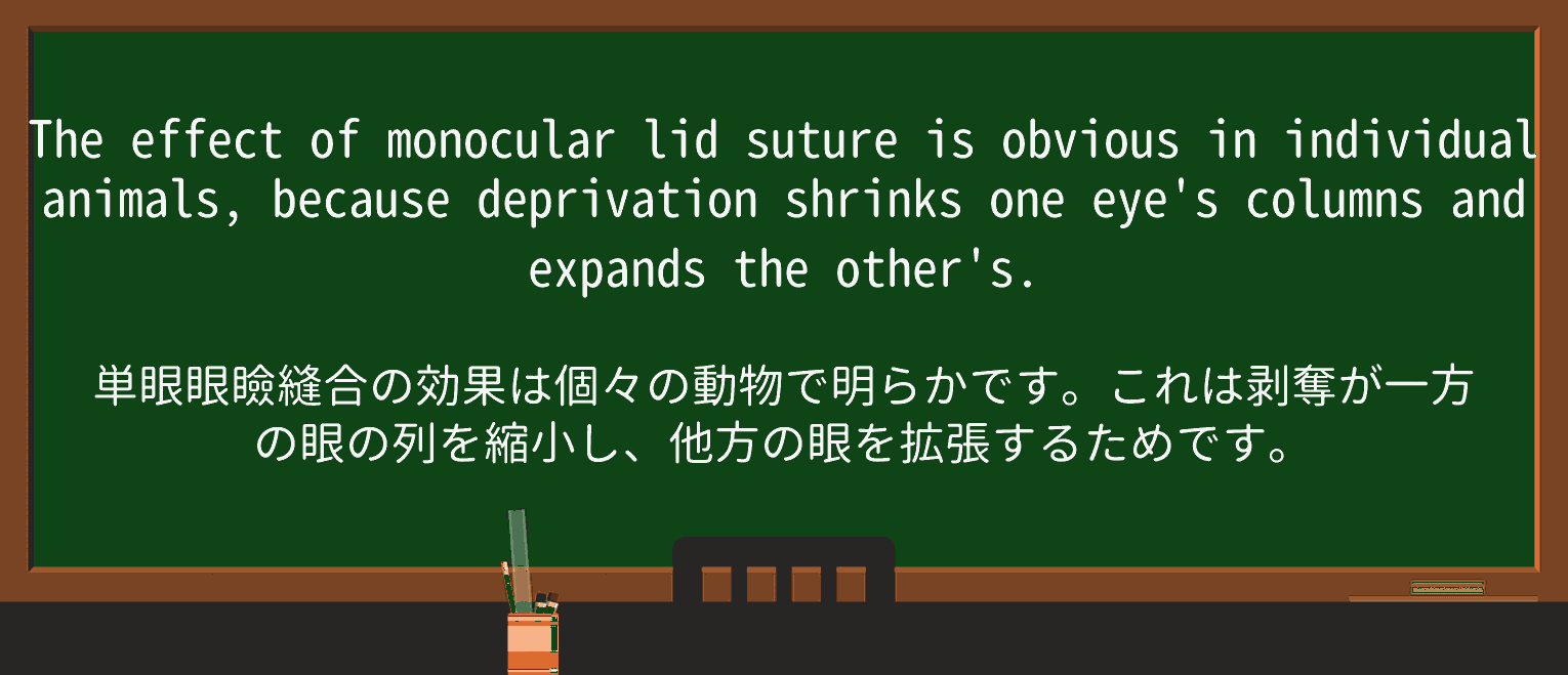 【英単語】sutureを徹底解説!意味、使い方、例文、読み方 ・例文2