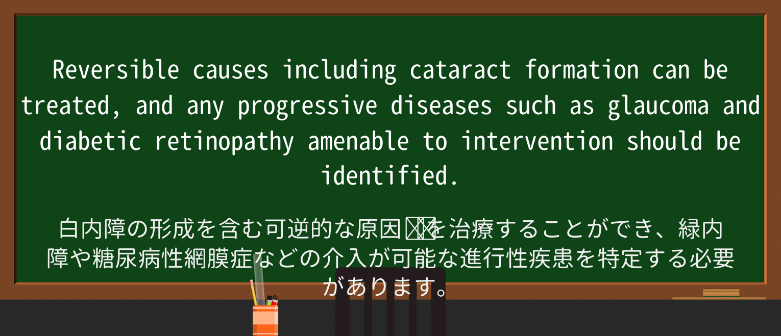 【英単語】reversibleを徹底解説!意味、使い方、例文、読み方 ・例文2