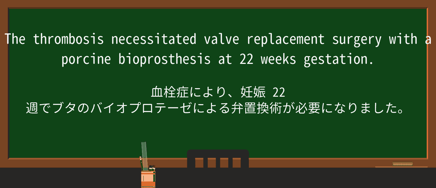 【英単語】thrombosisを徹底解説!意味、使い方、例文、読み方 ・例文2