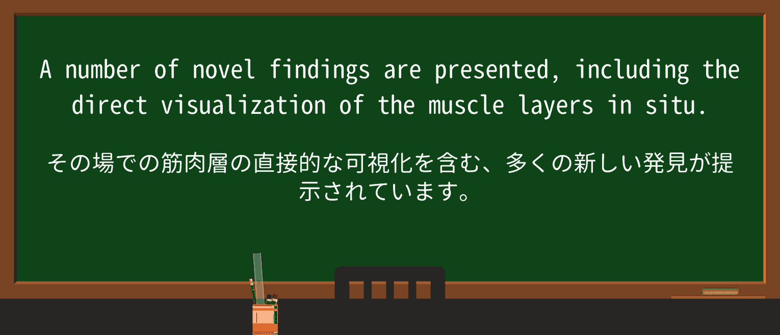 【英単語】visualizationを徹底解説!意味、使い方、例文、読み方 ・例文3